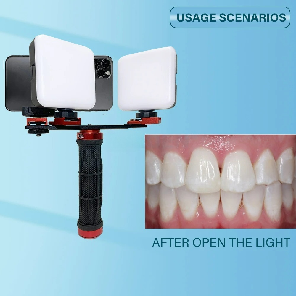 Dental Photography Light Phone - огляд і ціна Phone Accessories For Photography